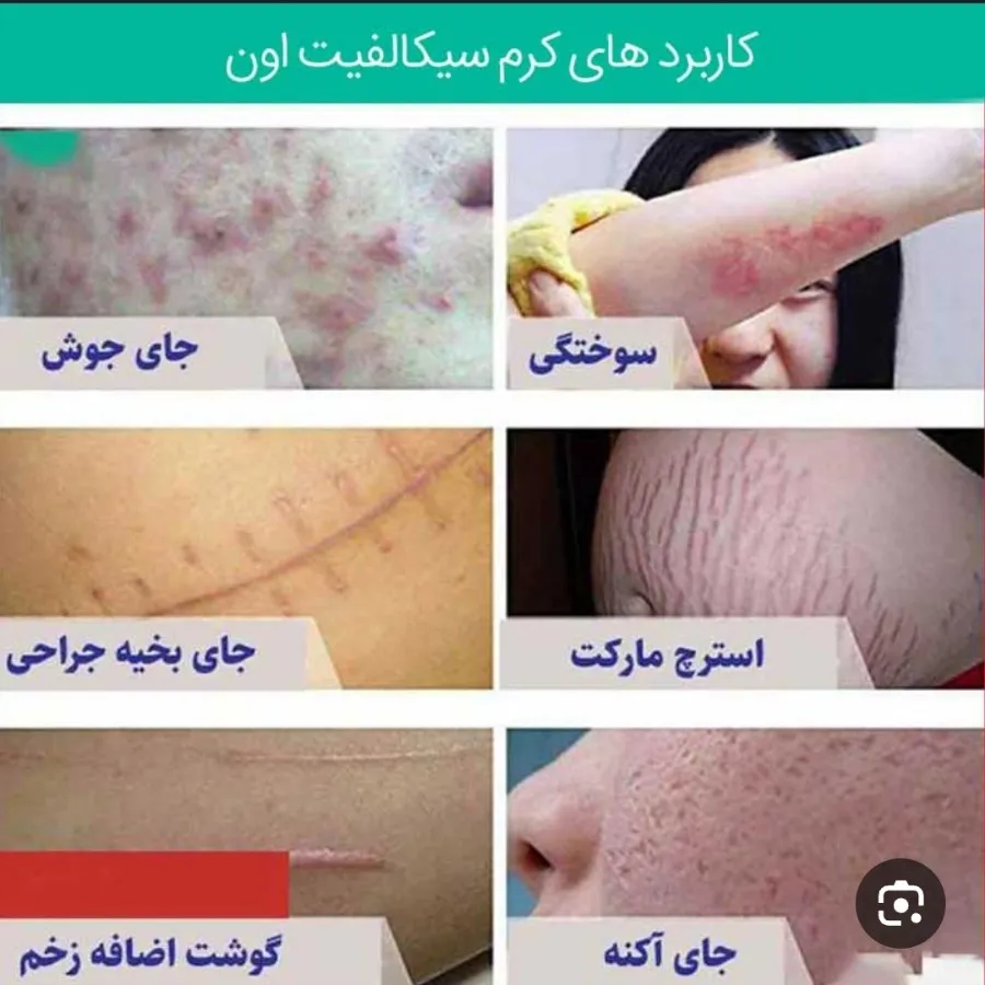 کرم ترمیمی