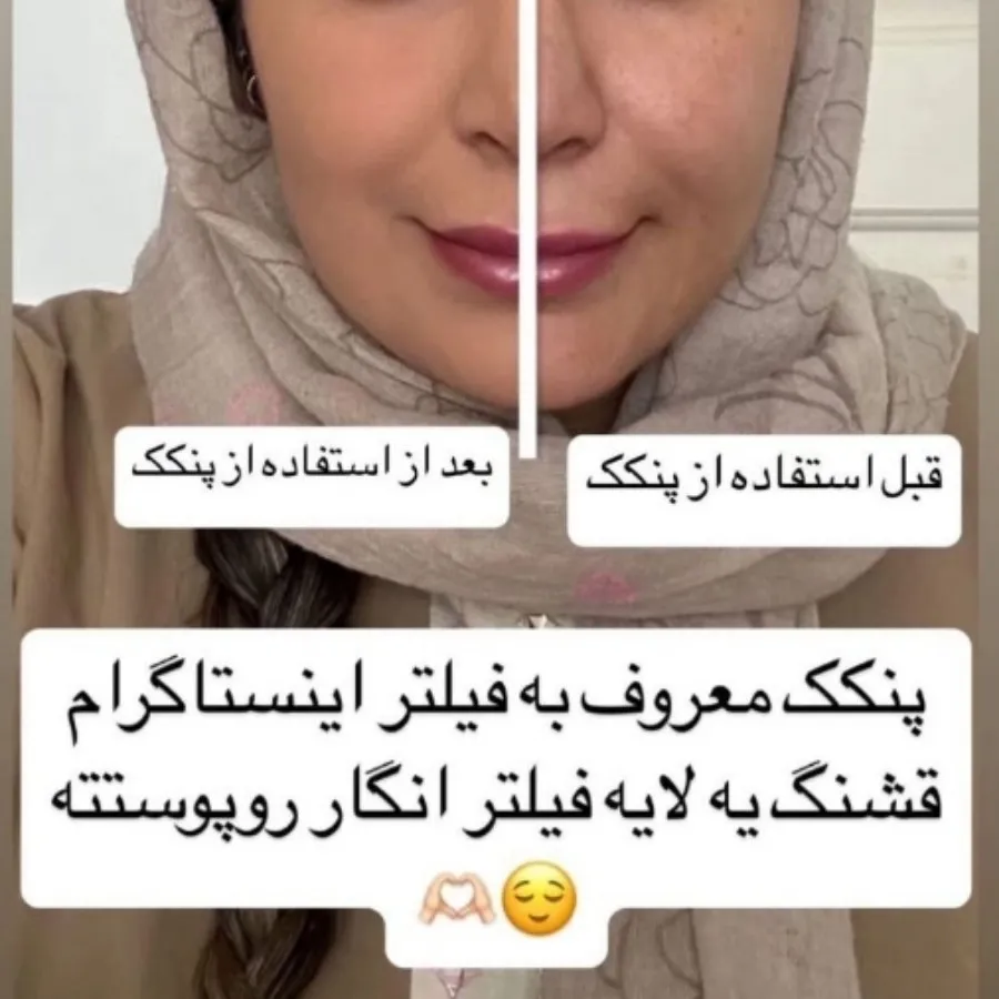 پنکک لاکچری کوین