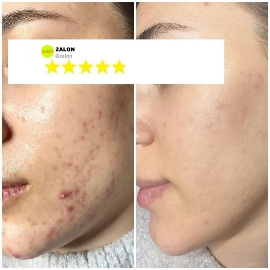 ماسک صورت درمانی زردچوبه