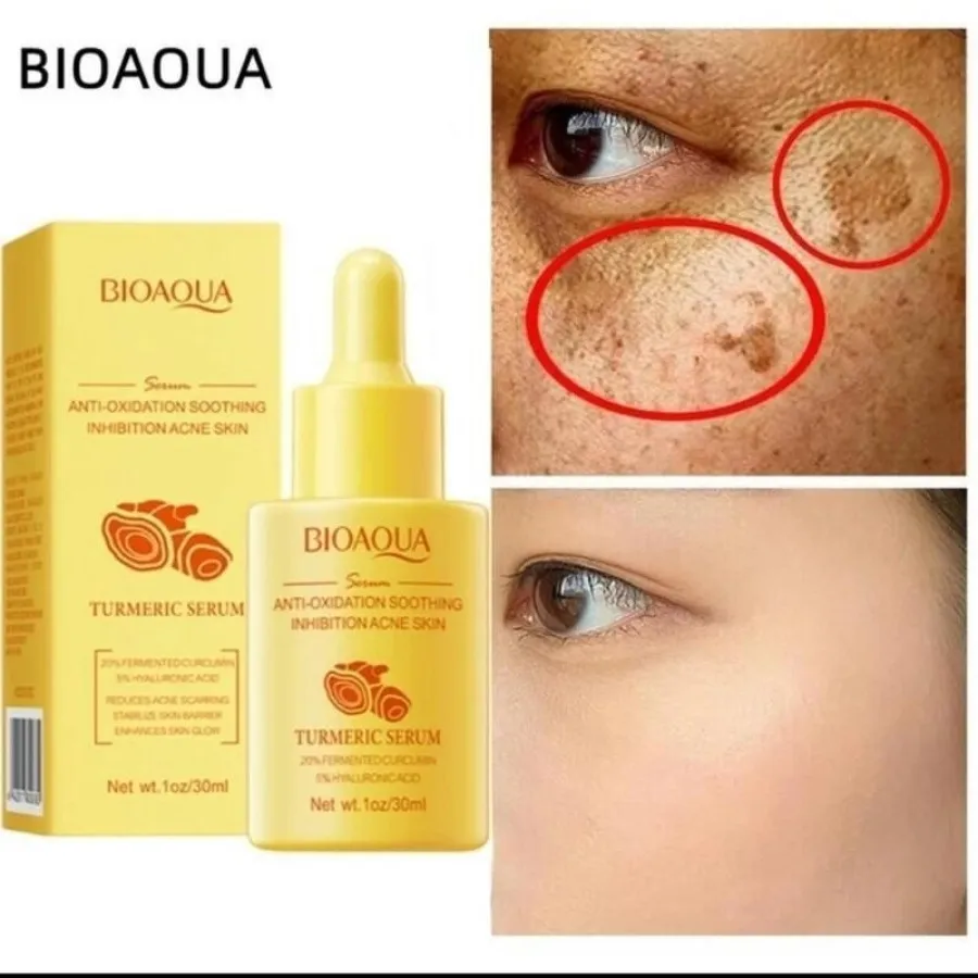سرم صورت زردچوبه بیوآکوا