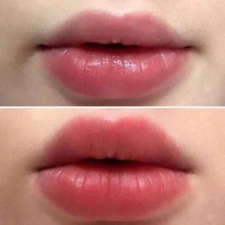 حجم دهنده لب مینی گربه