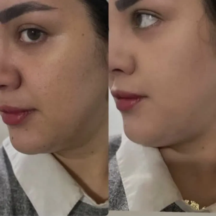 پنکک لاکچری کوین