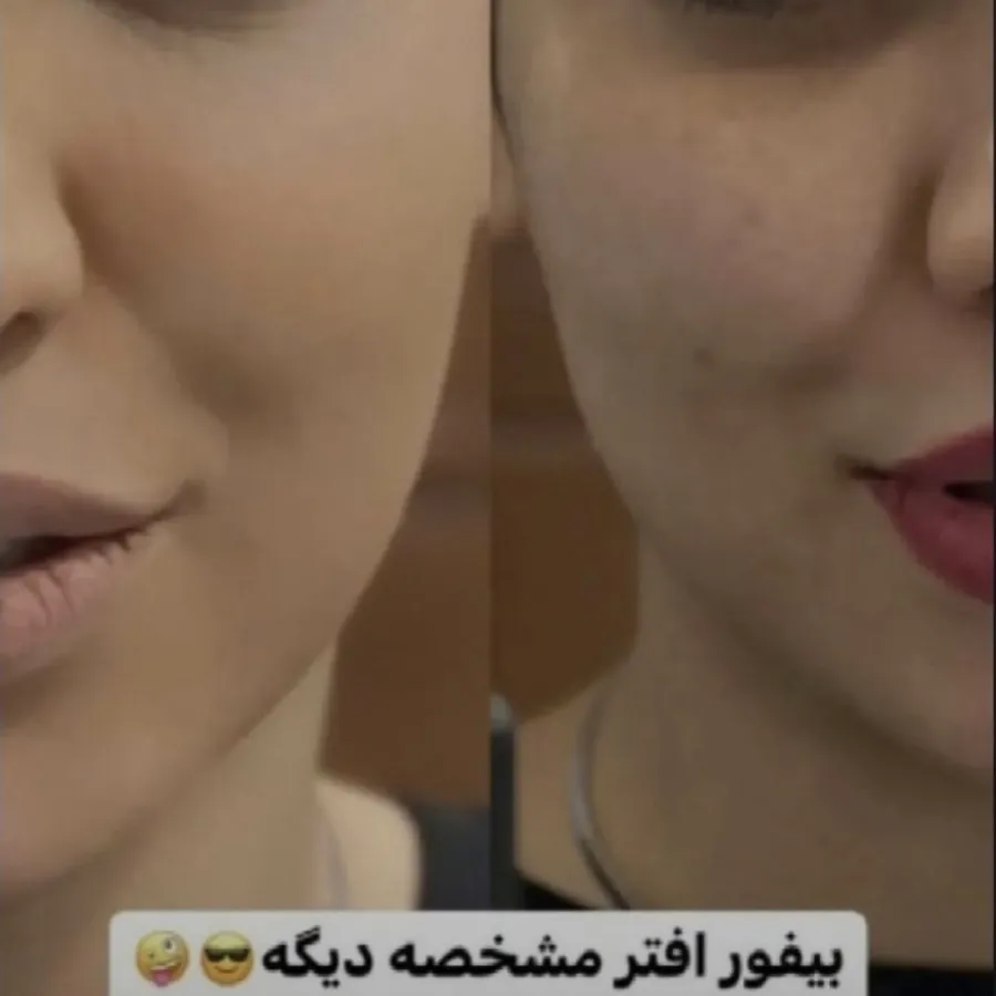 پنکک لاکچری کویین