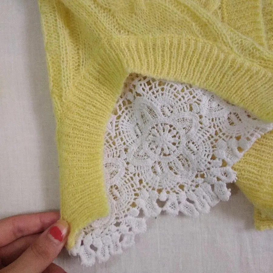 بافت زرد گوگولی