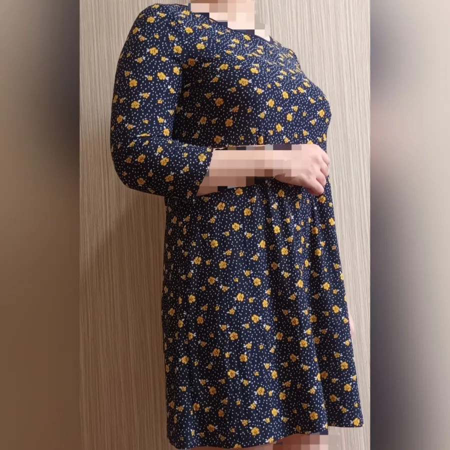 تونیک خارجی