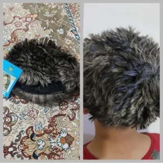 پوستیژ تیفوسی خوشگل