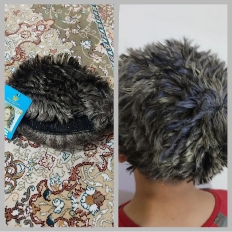 پوستیژ تیفوسی خوشگل