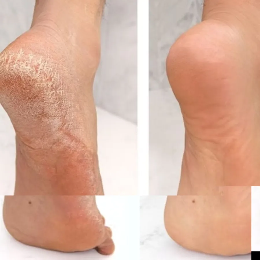 جوراب و دستکش سیلیکونی