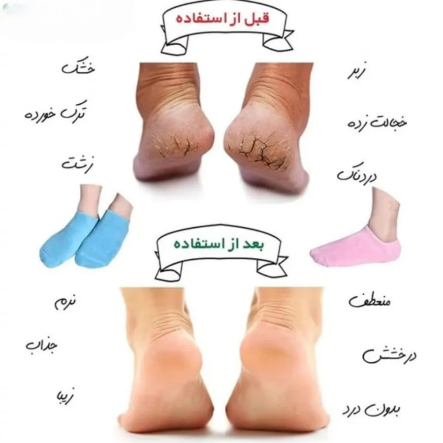 جوراب و دستکش سیلیکونی