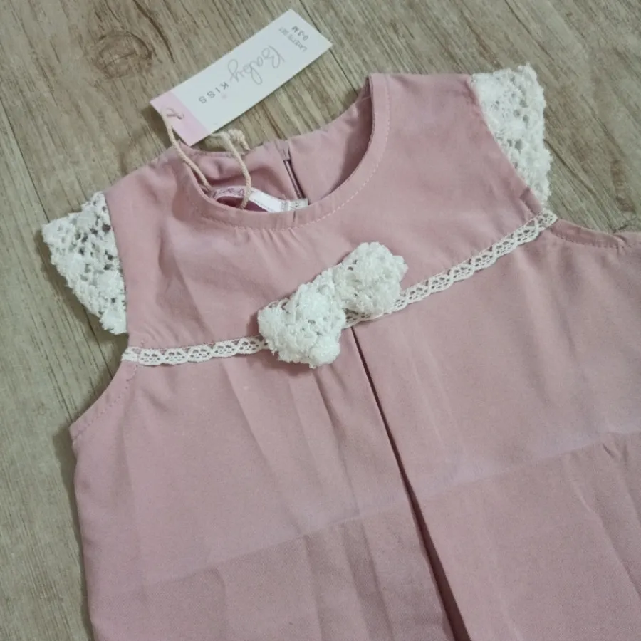 پیراهن دانتل