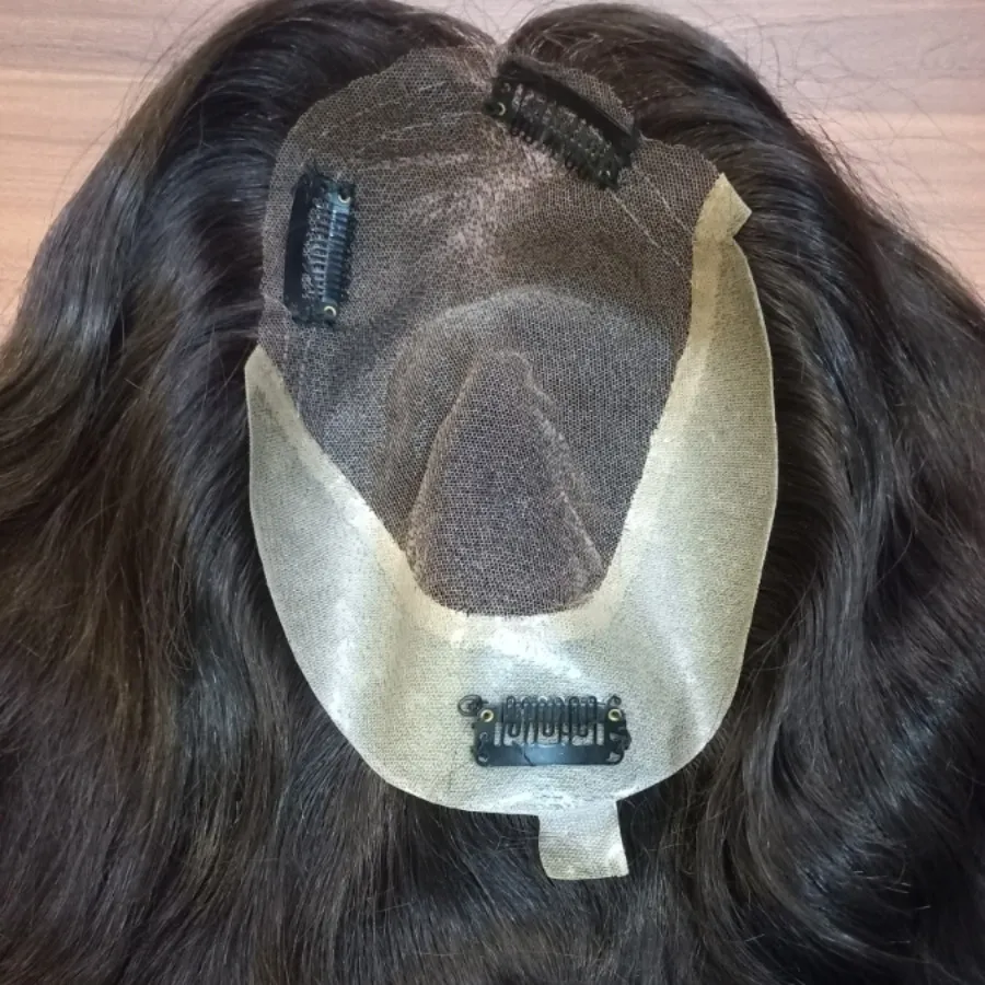 پروتز موی بالا سر