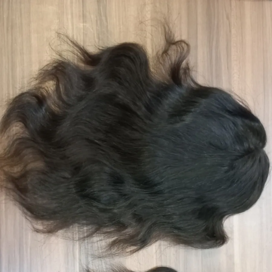 پروتز موی سر