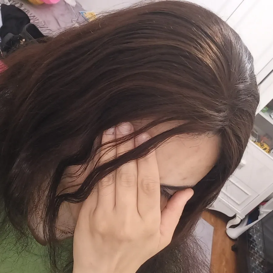 پروتز موی گیره ای