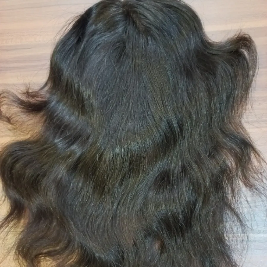 پروتز گیره ای مو