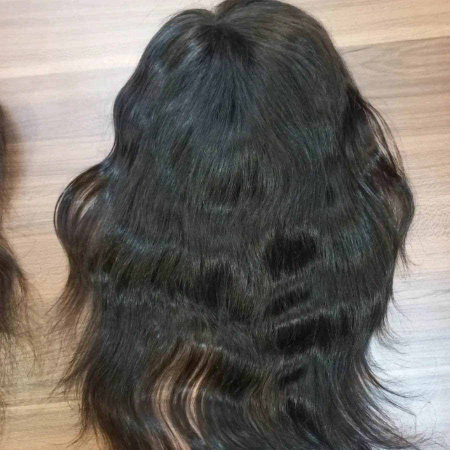 پروتز گیره ای مو