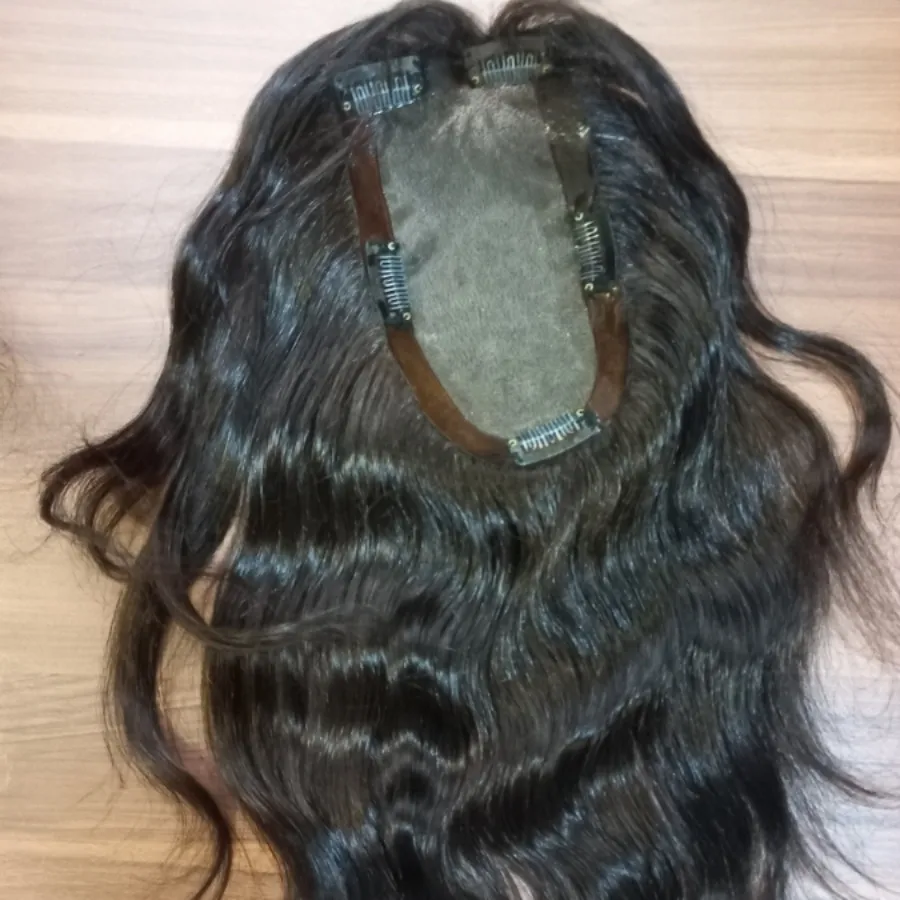 پروتز گیره ای مو