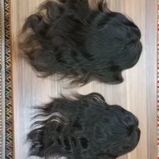 پروتز موی بالا سر