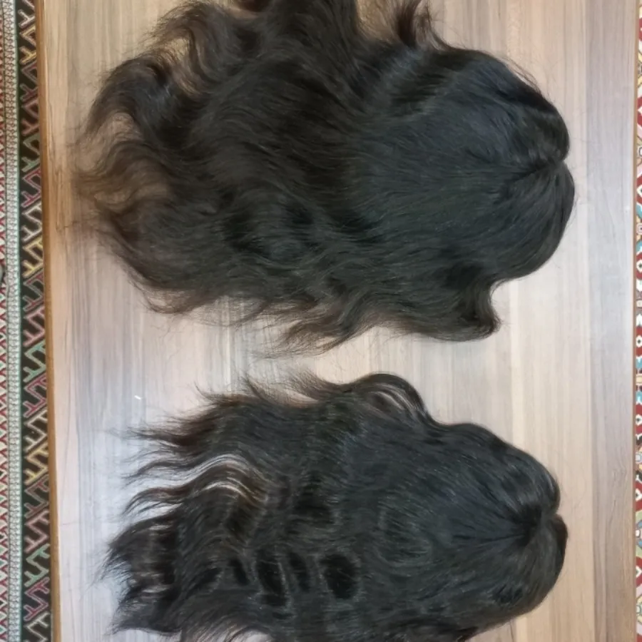 پروتز موی بالا سر