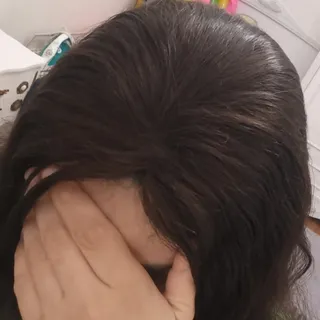 پروتز موی گیره ای