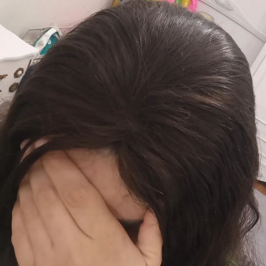 پروتز موی گیره ای