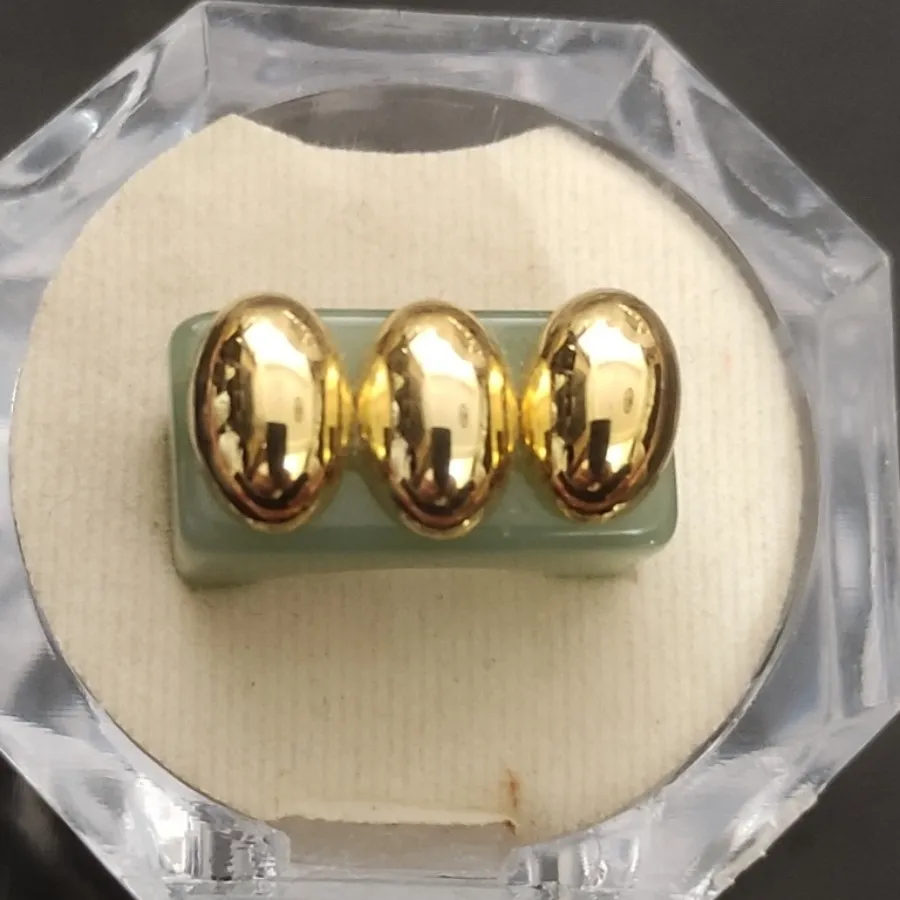 انگشتر بسیار خاص وزیبا