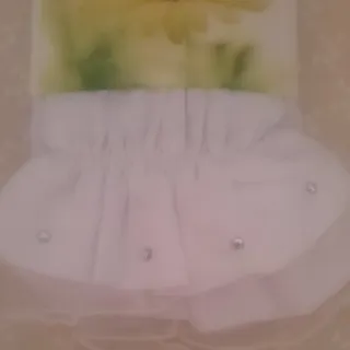 ساق دست