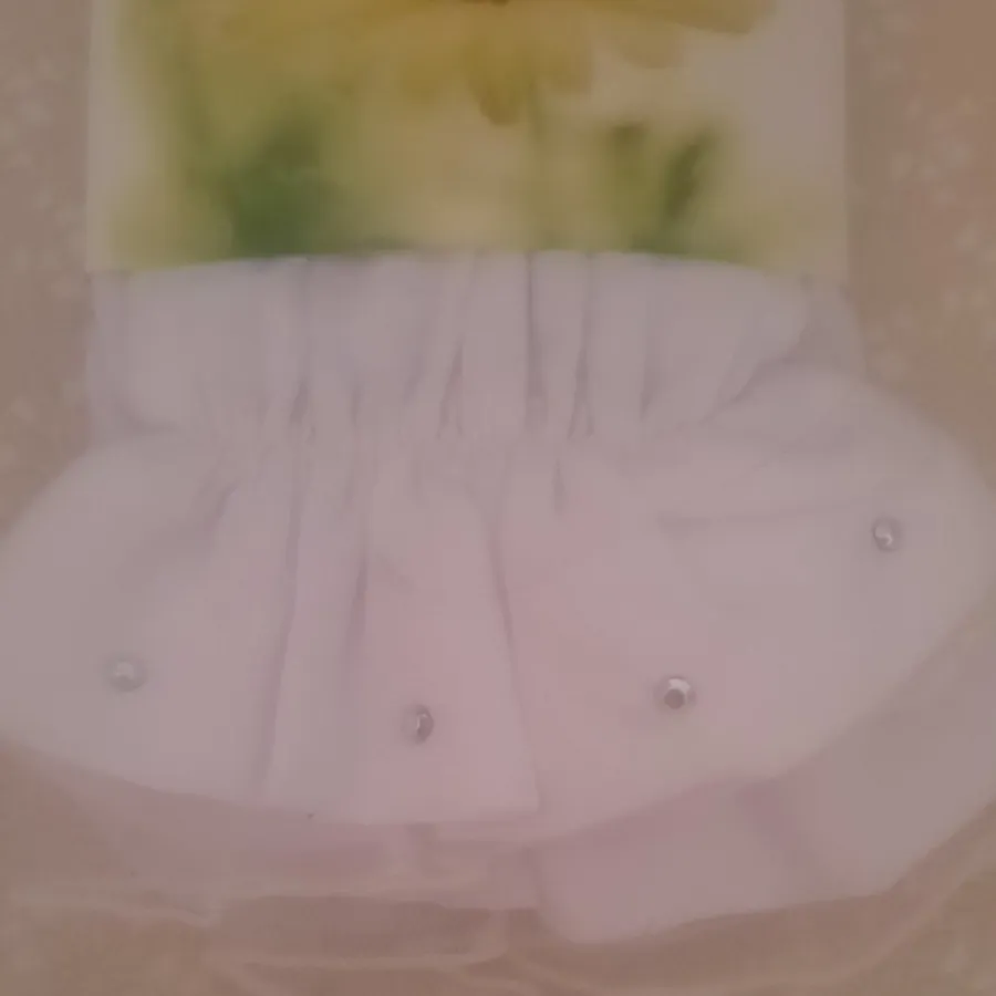 ساق دست