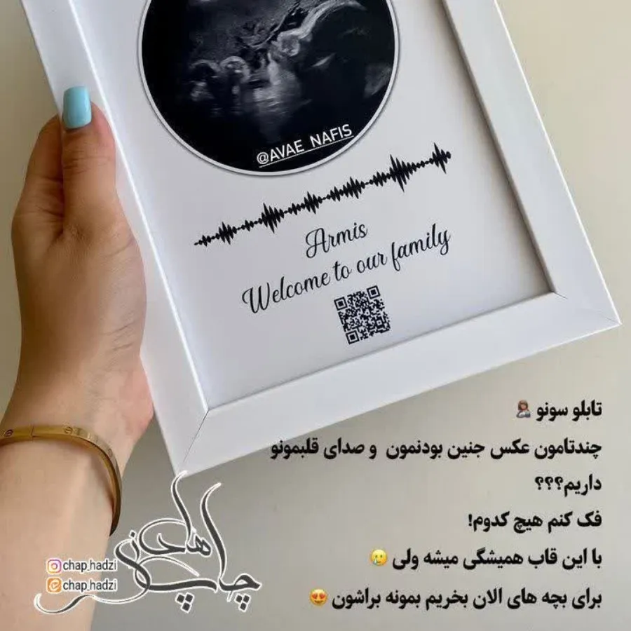 تابلو سونو