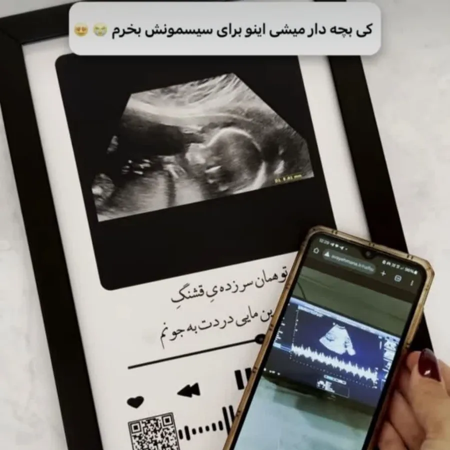 تابلو سونو