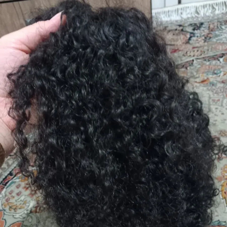پروتز مو