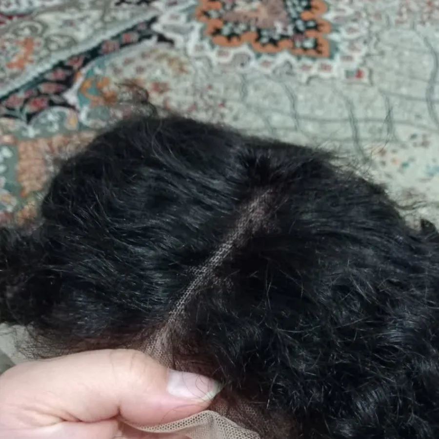 پروتز مو