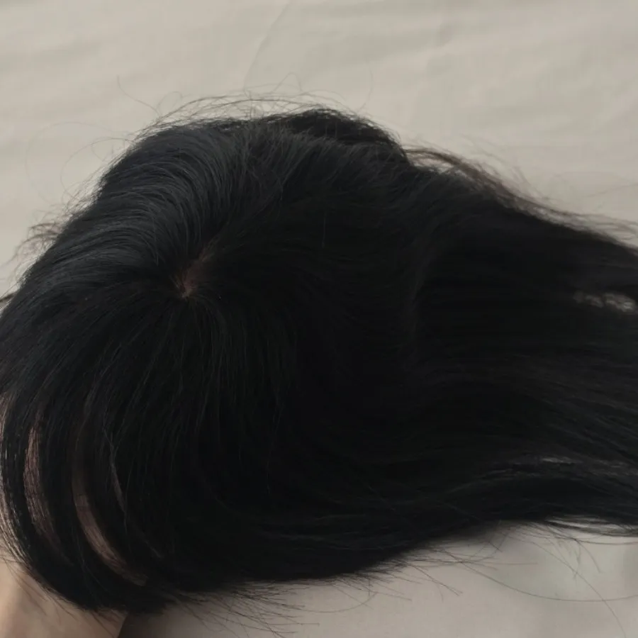 پرتز مو
