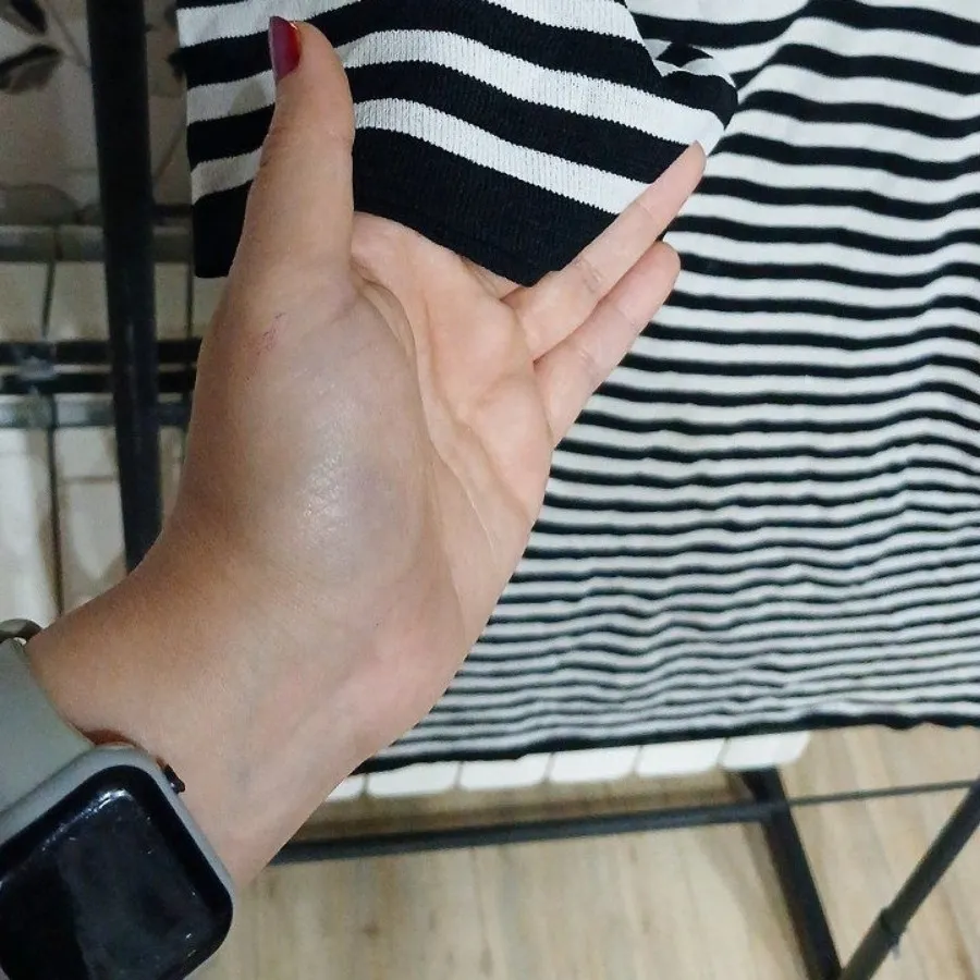 بافت ریز لش
خارجی
لش✅️