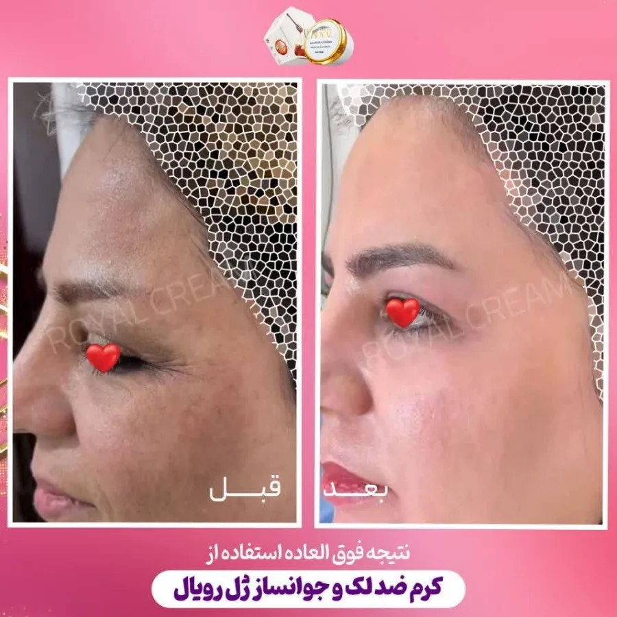 پک ژل رویال آواطب