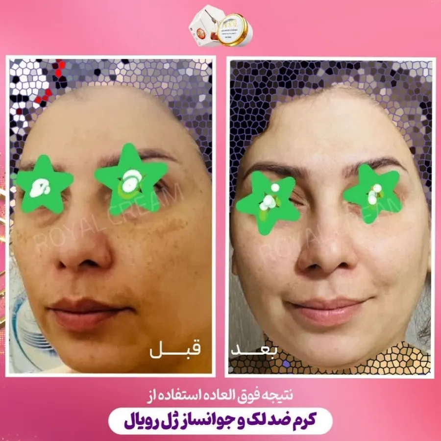 پک ژل رویال آواطب