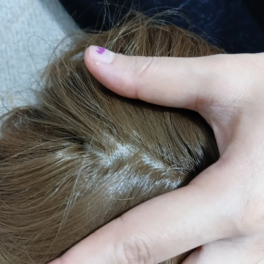 پوستیژکف سری