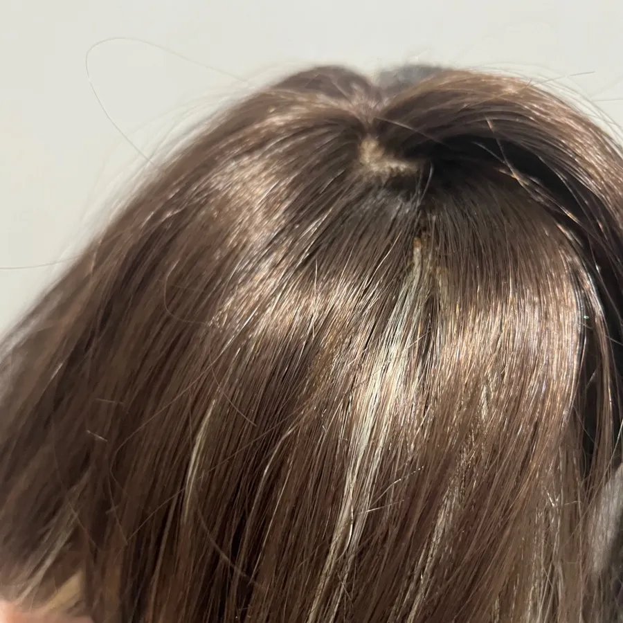 کلاهگیس طبیعی فرق پوستی